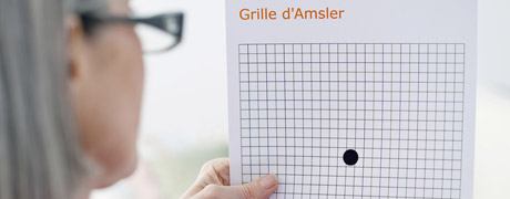 DMLA